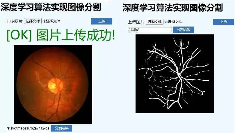 医学影像与图像分割：深度学习项目课